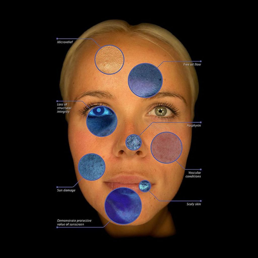 Detailed Skin Analysis