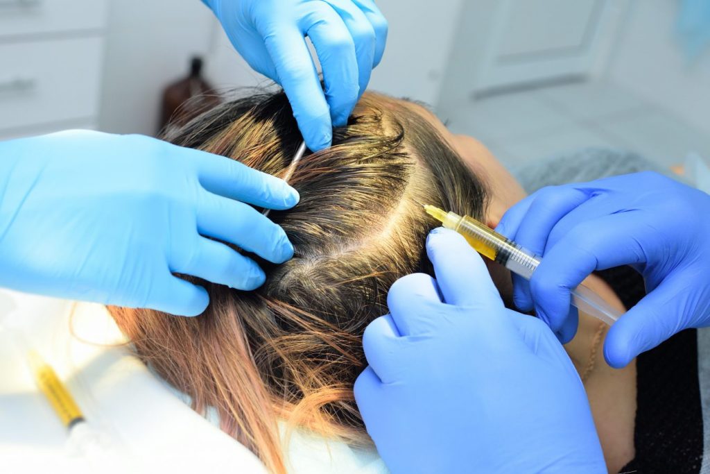 PRP injection hair restoration