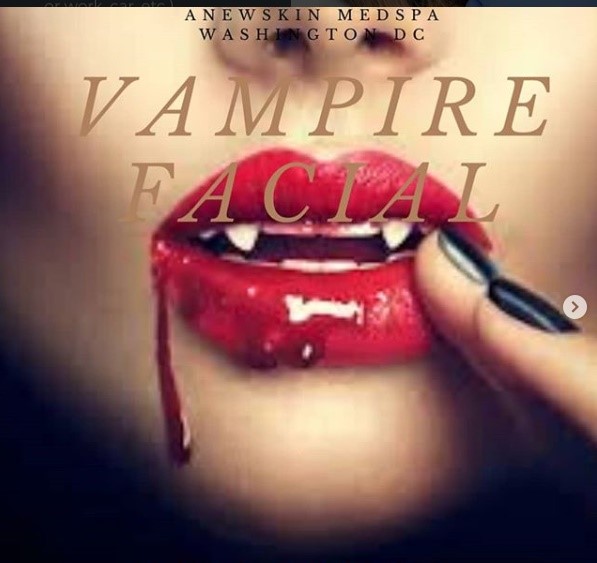 Vampire Face-lift - AnewSkin Aesthetic Clinic and Medical Spa